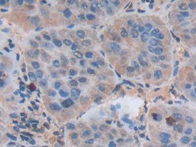 膜聯(lián)蛋白A3(ANXA3)多克隆抗體