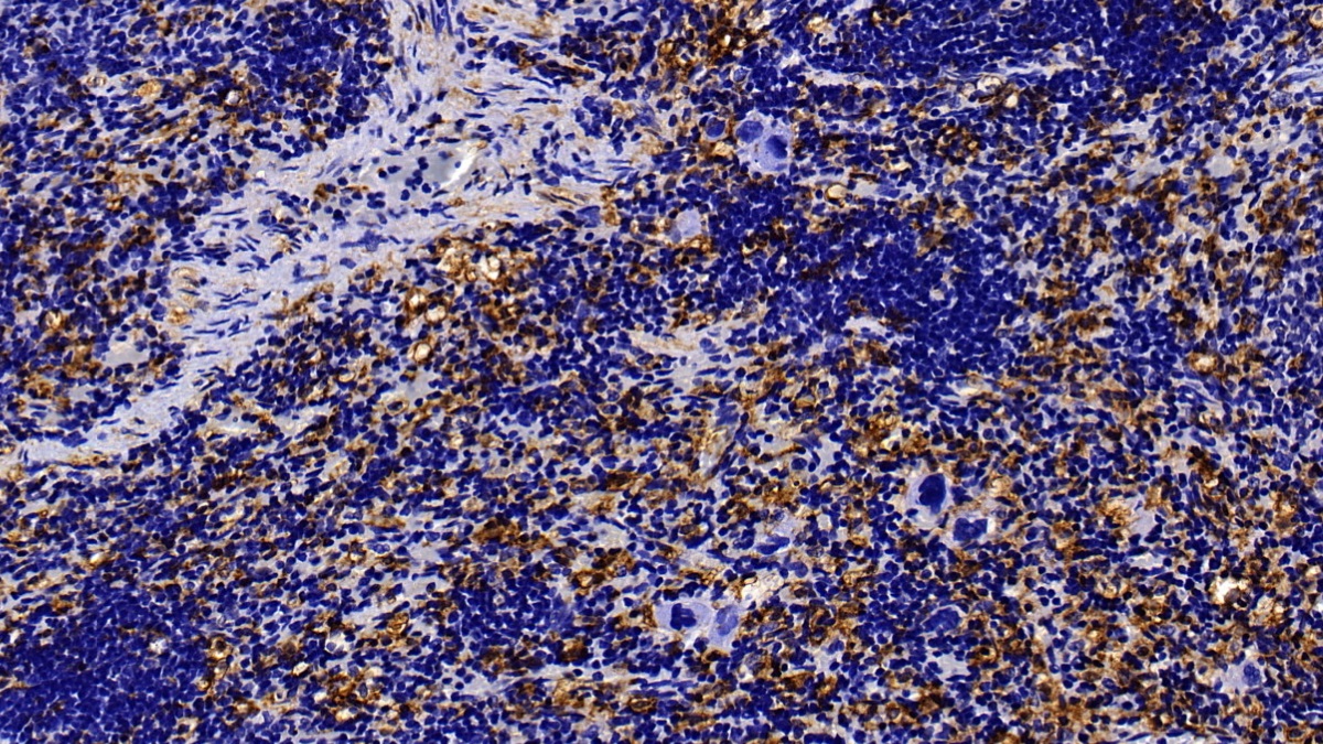 膜聯(lián)蛋白A3(ANXA3)多克隆抗體