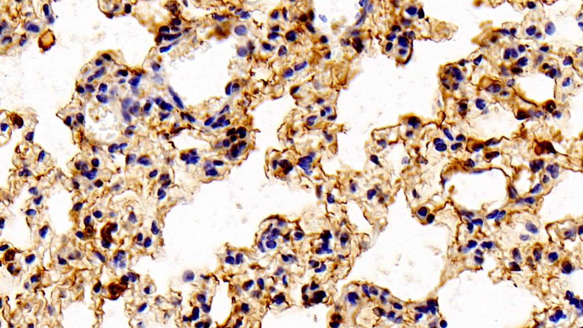膜聯(lián)蛋白A1(ANXA1)多克隆抗體