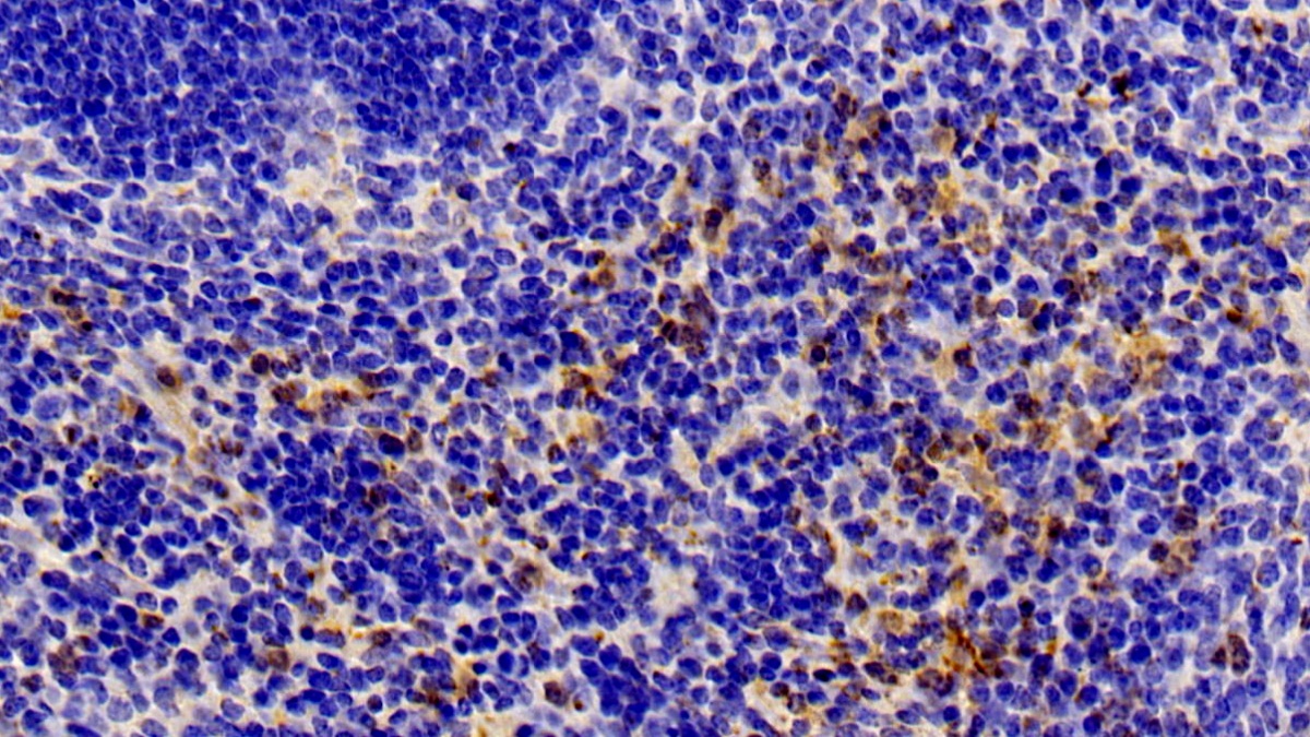 膜聯(lián)蛋白A1(ANXA1)多克隆抗體