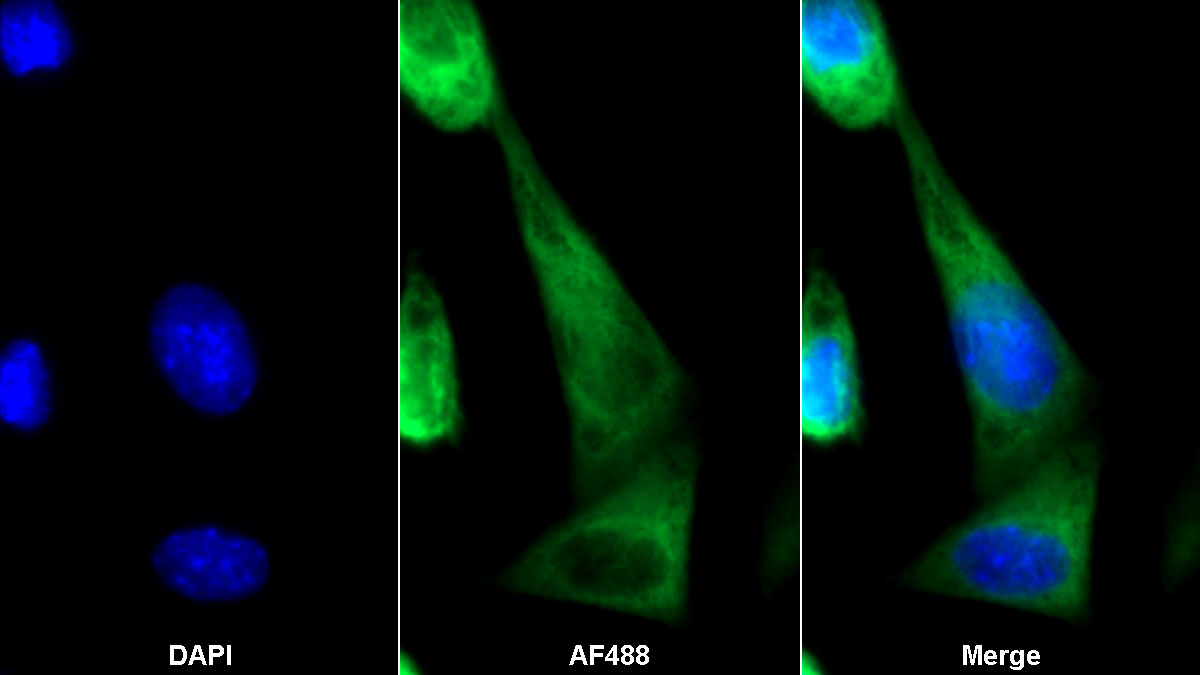 膜聯(lián)蛋白A1(ANXA1)多克隆抗體
