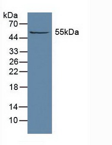 醛脫氫酶1家族成員A1(ALDH1A1)多克隆抗體