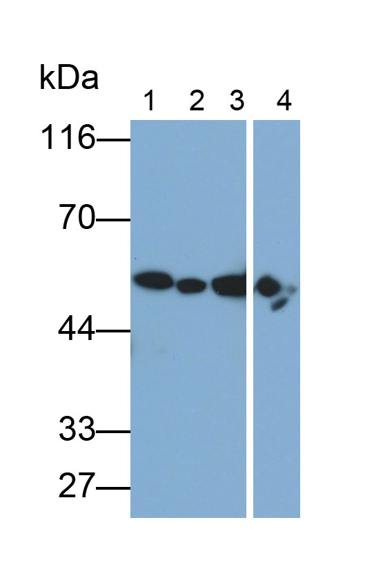 醛脫氫酶1家族成員A1(ALDH1A1)多克隆抗體