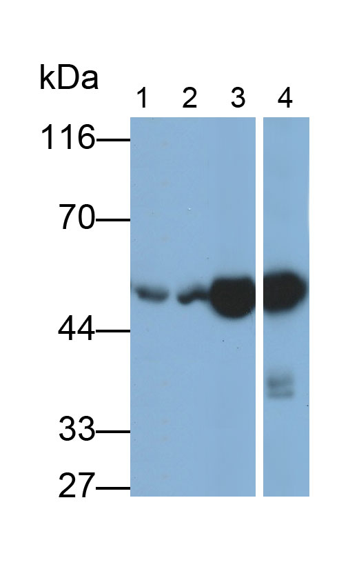 醛脫氫酶1家族成員A1(ALDH1A1)多克隆抗體