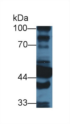 醛脫氫酶1家族成員A1(ALDH1A1)多克隆抗體