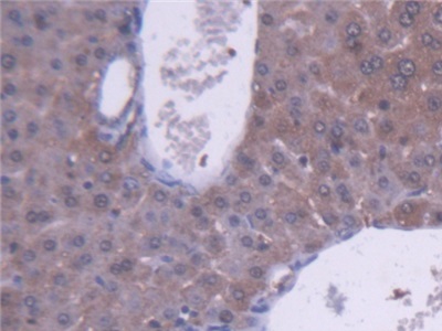 醛脫氫酶1家族成員A1(ALDH1A1)多克隆抗體