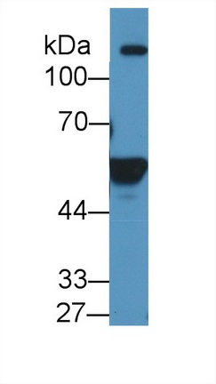 醛脫氫酶1家族成員A2(ALDH1A2)多克隆抗體