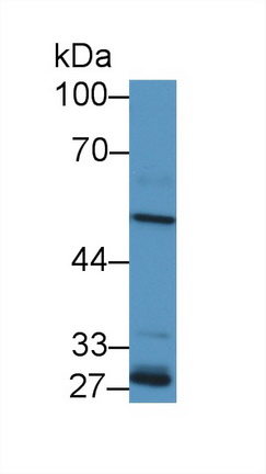 醛脫氫酶1家族成員A2(ALDH1A2)多克隆抗體