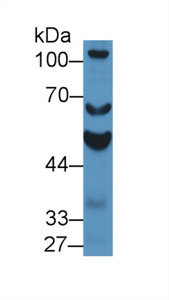醛脫氫酶1家族成員A2(ALDH1A2)多克隆抗體
