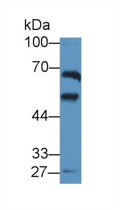 醛脫氫酶1家族成員A2(ALDH1A2)多克隆抗體