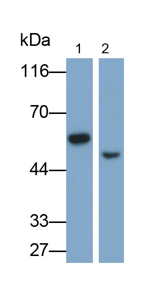 醛脫氫酶1家族成員A3(ALDH1A3)多克隆抗體