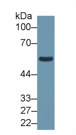 醛脫氫酶1家族成員B1(ALDH1B1)多克隆抗體