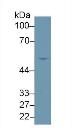 醛脫氫酶1家族成員B1(ALDH1B1)多克隆抗體