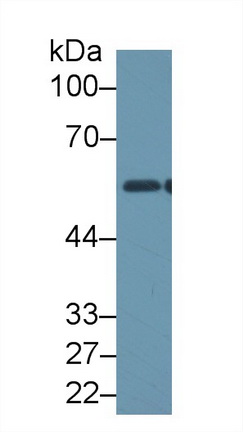 醛脫氫酶1家族成員B1(ALDH1B1)多克隆抗體