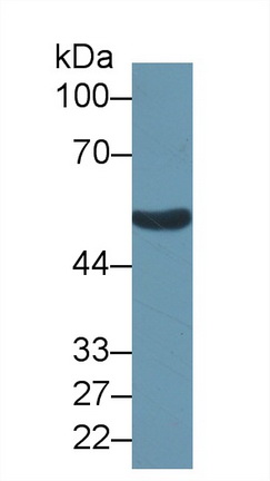 醛脫氫酶1家族成員B1(ALDH1B1)多克隆抗體