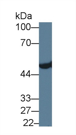 醛脫氫酶3家族成員A1(ALDH3A1)多克隆抗體