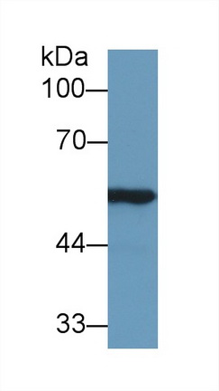 醛脫氫酶7家族成員A1(ALDH7A1)多克隆抗體