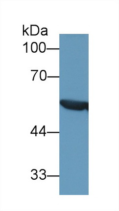 醛脫氫酶7家族成員A1(ALDH7A1)多克隆抗體