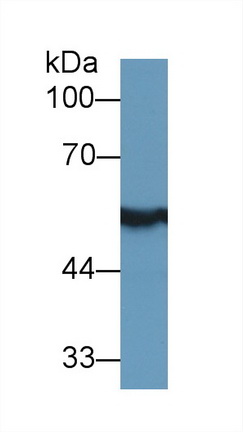 醛脫氫酶7家族成員A1(ALDH7A1)多克隆抗體
