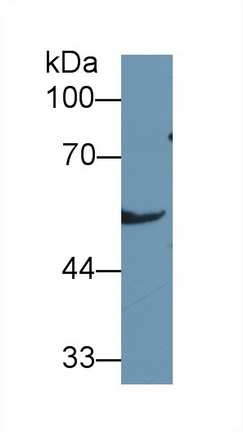 醛脫氫酶7家族成員A1(ALDH7A1)多克隆抗體