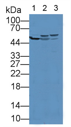 醛脫氫酶7家族成員A1(ALDH7A1)多克隆抗體