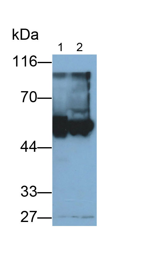 醛脫氫酶7家族成員A1(ALDH7A1)多克隆抗體