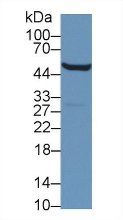 醛脫氫酶9家族成員A1(ALDH9A1)多克隆抗體