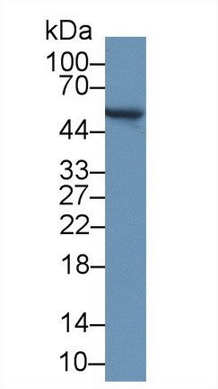 醛脫氫酶9家族成員A1(ALDH9A1)多克隆抗體