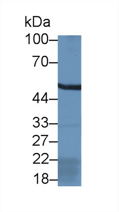 醛脫氫酶9家族成員A1(ALDH9A1)多克隆抗體