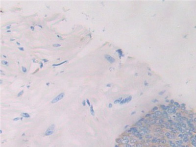 白介素1ζ(IL1z)多克隆抗體