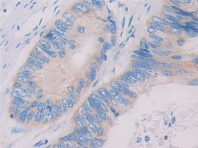 白介素1ζ(IL1z)多克隆抗體