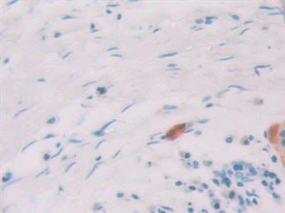 白介素1ζ(IL1z)多克隆抗體