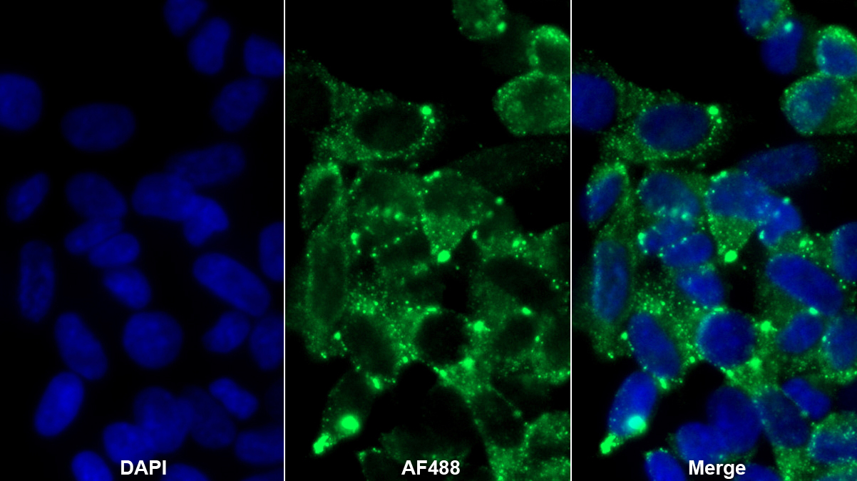 連環(huán)蛋白β相互作用蛋白1(CTNNbIP1)多克隆抗體