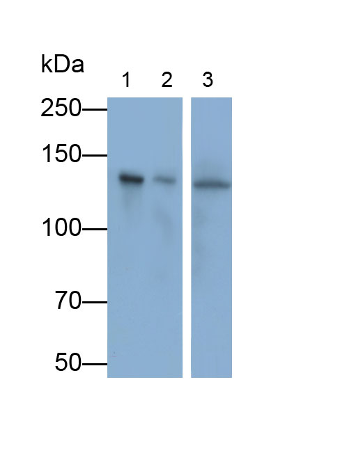 组蛋白脱乙酰基酶4(HDAC4)多克隆抗体