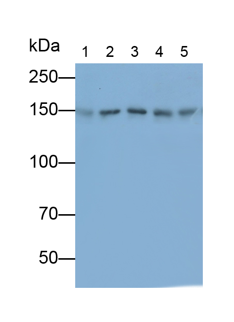 组蛋白脱乙酰基酶6(HDAC6)多克隆抗体