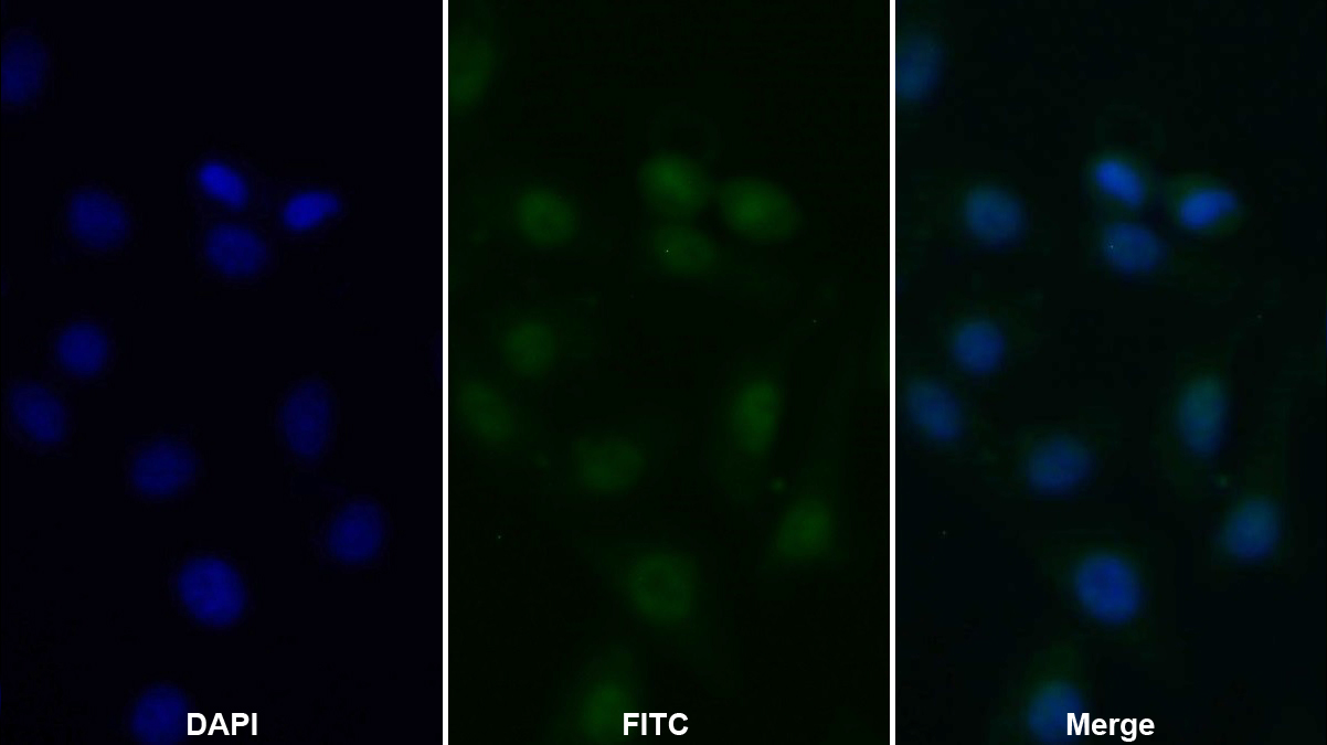 组蛋白脱乙酰基酶6(HDAC6)多克隆抗体