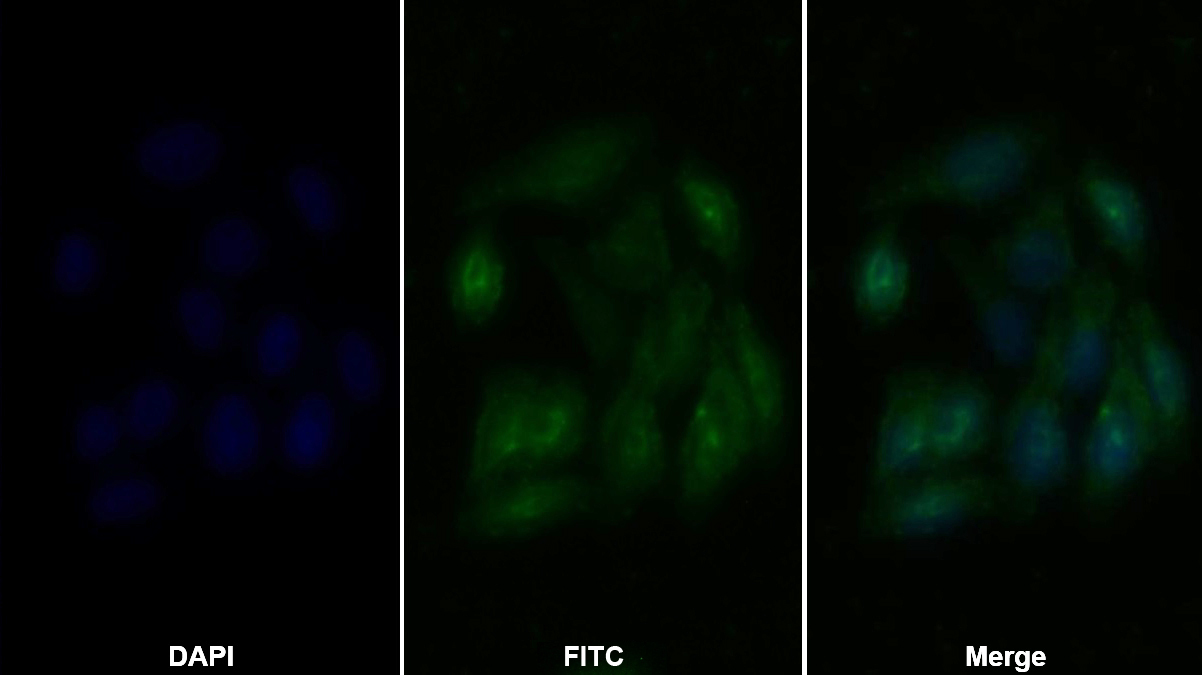 組蛋白脫乙?；?(HDAC6)多克隆抗體