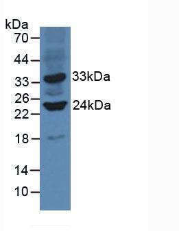沉默調(diào)節(jié)蛋白3(SIRT3)多克隆抗體