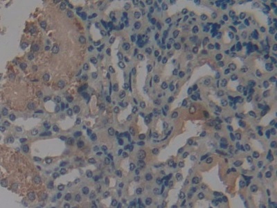 沉默調(diào)節(jié)蛋白3(SIRT3)多克隆抗體