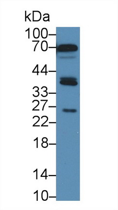 沉默調(diào)節(jié)蛋白4(SIRT4)多克隆抗體