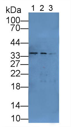 沉默調(diào)節(jié)蛋白6(SIRT6)多克隆抗體