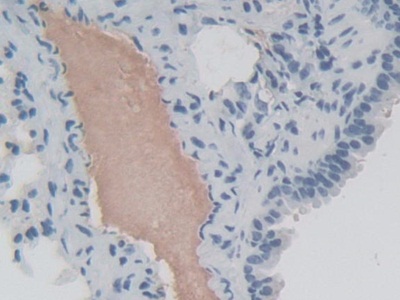 真核翻译起始因子2α激酶3(EIF2aK3)多克隆抗体