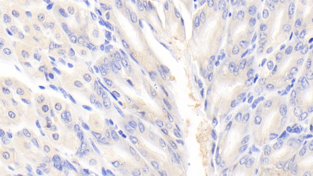 真核翻译起始因子2α激酶3(EIF2aK3)多克隆抗体