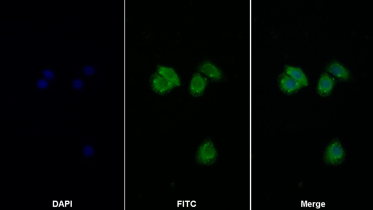 真核翻译起始因子2α激酶3(EIF2aK3)多克隆抗体
