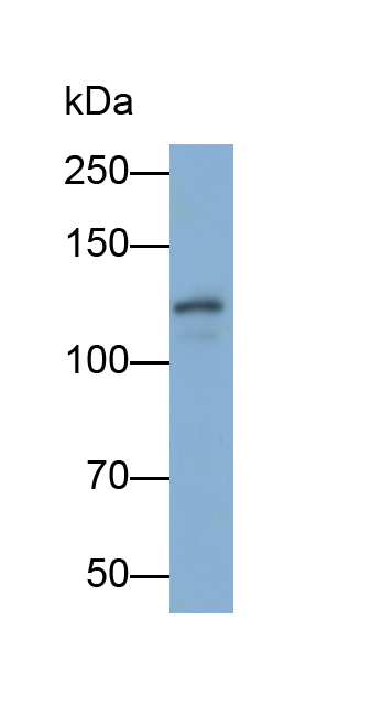 真核翻译起始因子2α激酶3(EIF2aK3)多克隆抗体