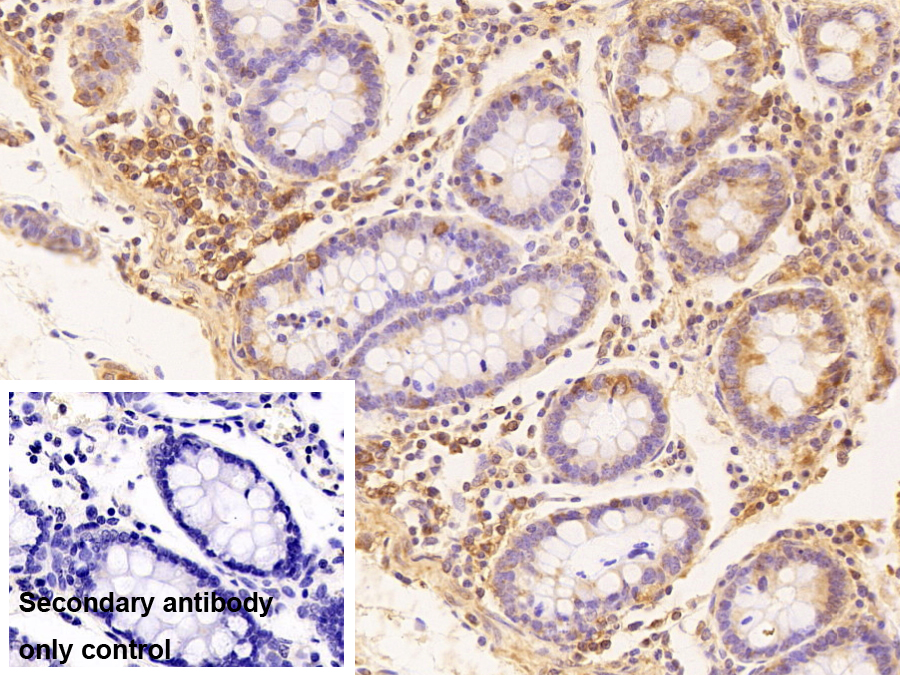 真核翻譯起始因子3M(EIF3M)多克隆抗體
