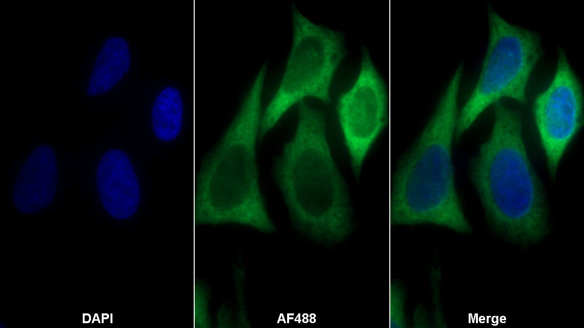 真核翻译延伸因子1α1(EEF1a1)多克隆抗体