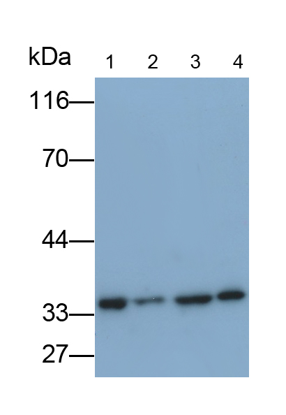 真核翻譯延伸因子1β2(EEF1b2)多克隆抗體