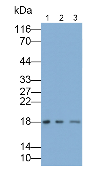 真核翻译延伸因子1ε1(EEF1e1)多克隆抗体