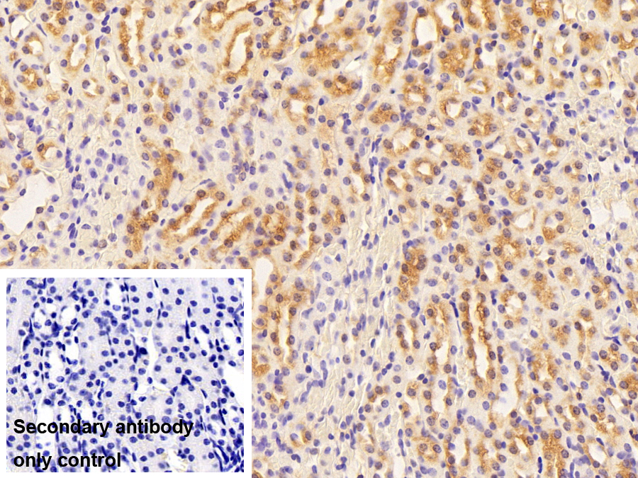 真核翻译延伸因子1ε1(EEF1e1)多克隆抗体